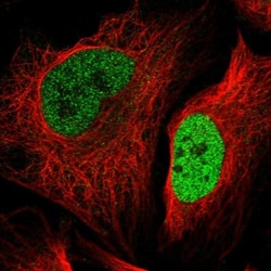 SUV420H2 Antibody, Novus Biologicals:Antibodies:Primary Antibodies